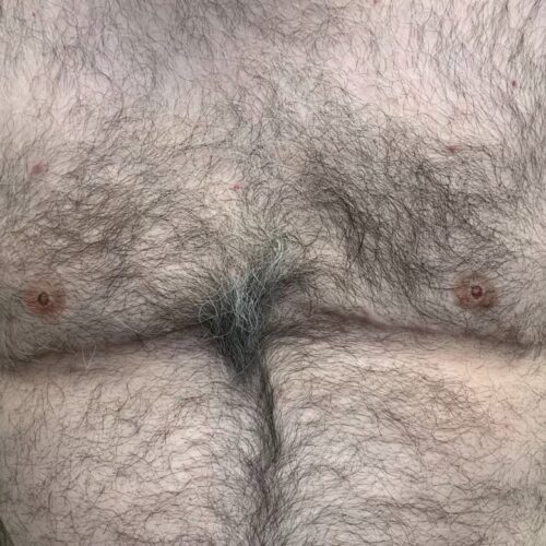 Areola Restoration Tattoo Vancouver DAELA Lina