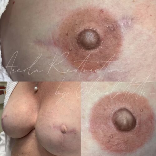 Areola Restoration Tattoo Vancouver DAELA Lina