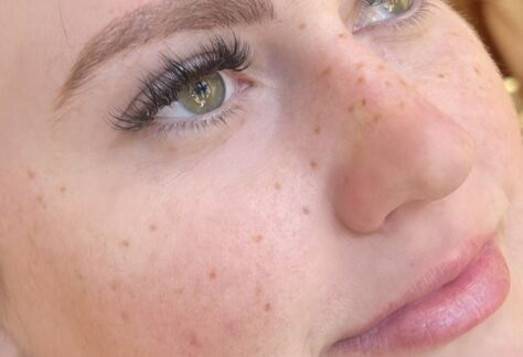 healed faux freckles allyssa
