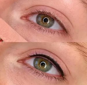 What the Eyeliner Tattoo Process Involves