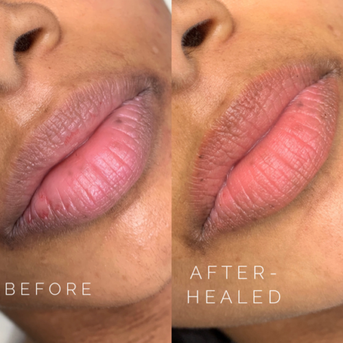 Lip Blush Tattoo for Dark Lip Neutralization