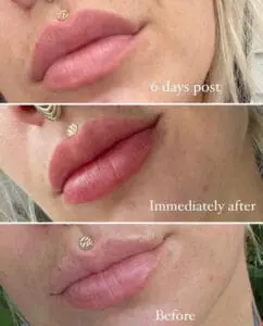 timeline of lip blush tattoo healing daela cosmetic tattoo