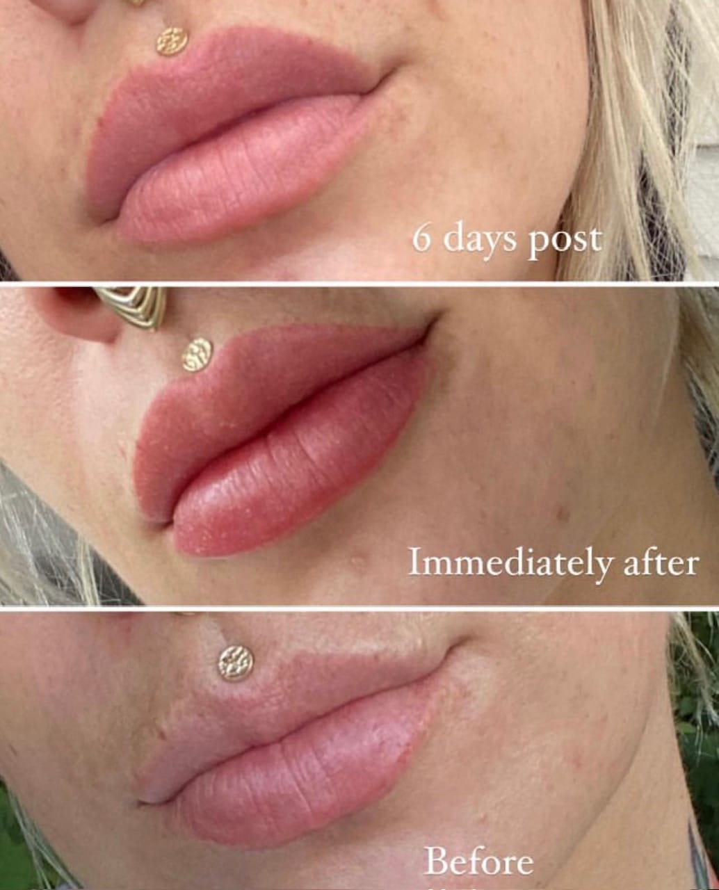 Lip Blush Tattoo Before And Aftercare DAELA