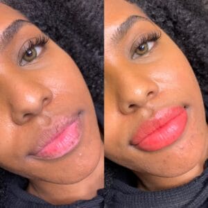 before and after lip neutralization with lip blushing