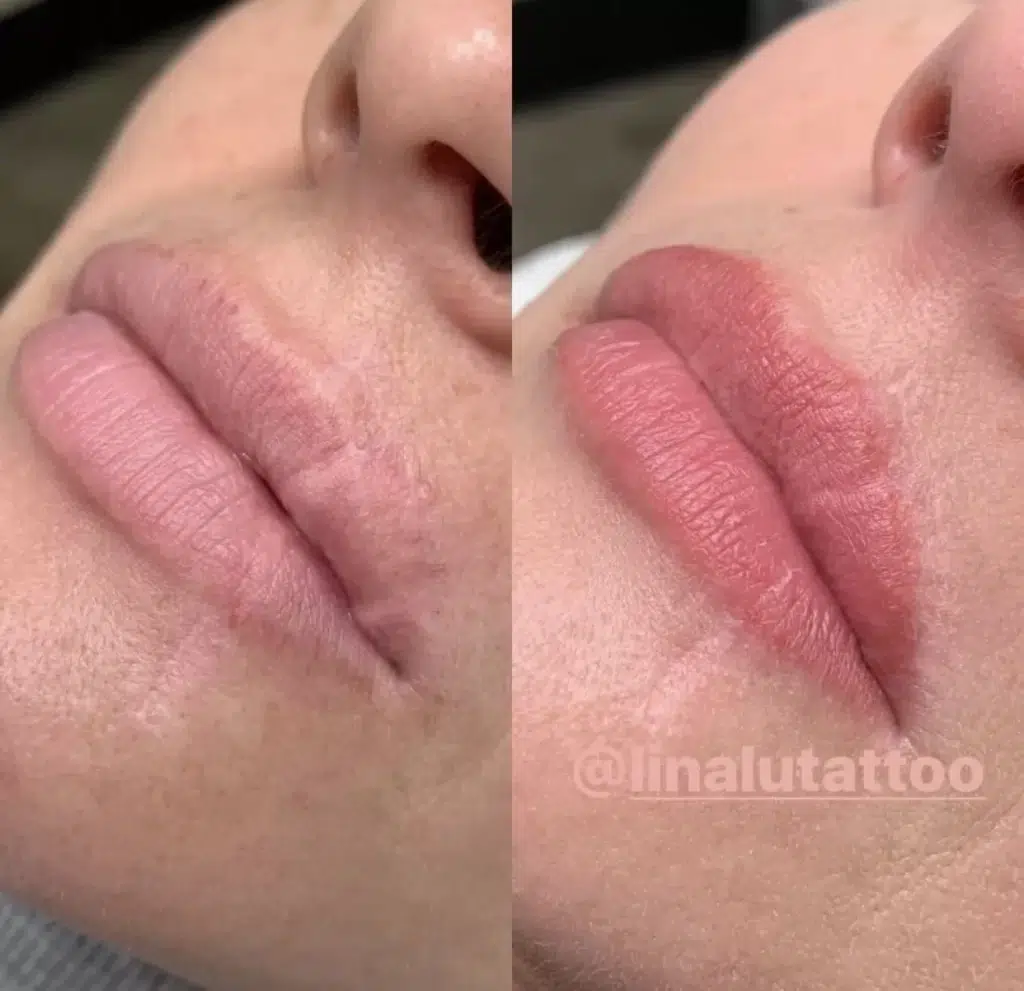 Can you cover up a scar with a tattoo