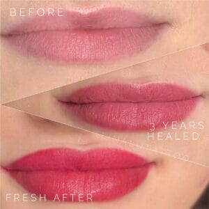 lip blush stages in years
