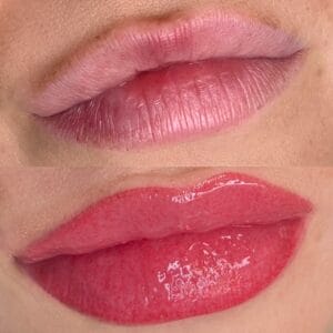 Lip Blush Tattoo vs. Lip Fillers - Choosing the Perfect Look for You