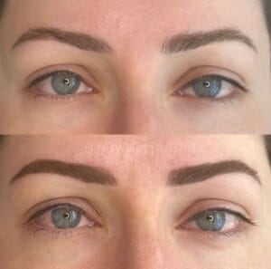 The Art of Patience: Navigating the Brow Shock Journey