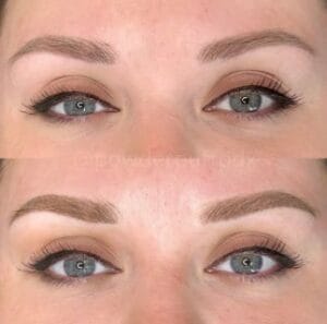 The Art of Patience: Navigating the Brow Shock Journey