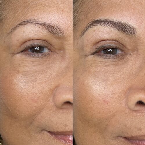 Machine Nano Brows in Scottsdale: Are They Right for You?