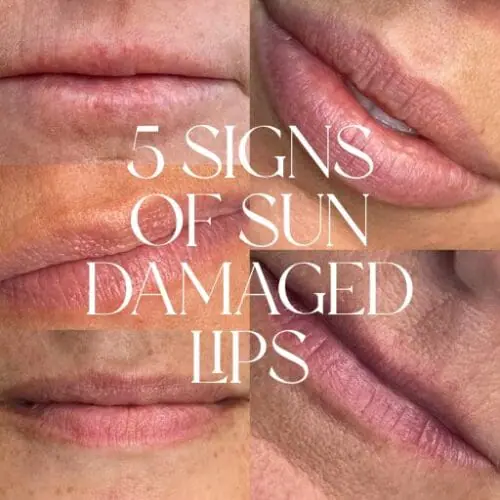 5 Signs Your Lips Need Some TLC