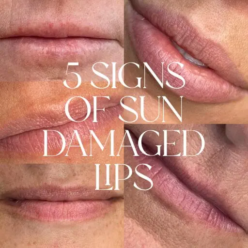5 Signs Your Lips Need Some TLC