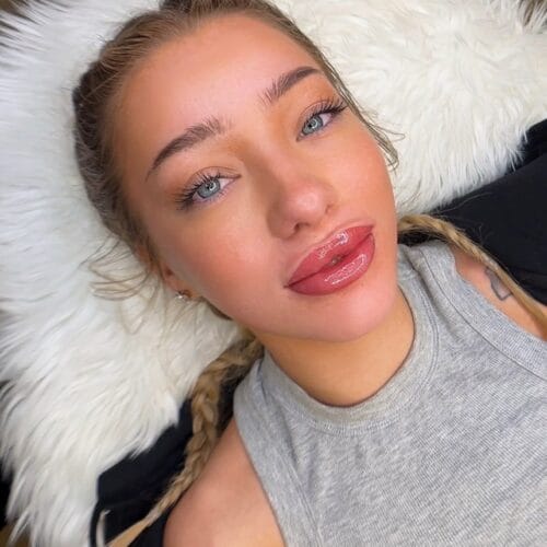 Enhancing Natural Beauty: Allie Harding’s Lip Blush Transformation