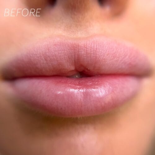 Lip Blush Tattoo at DAELA Cosmetic Tattoo