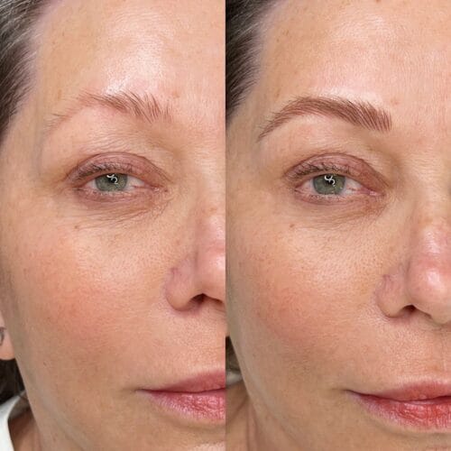 Machine Nano Brows: Why They’re the Smart Choice for Most Skin Types