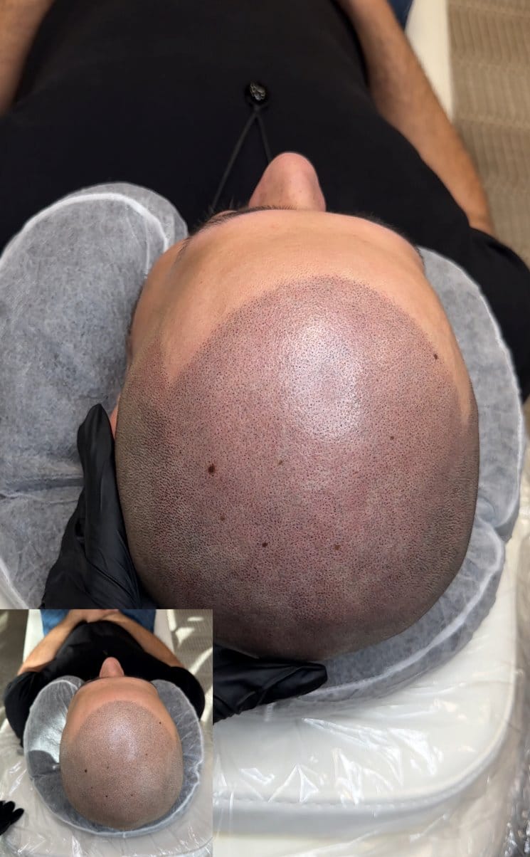 SMP at DAELA Cosmetic Tattoo