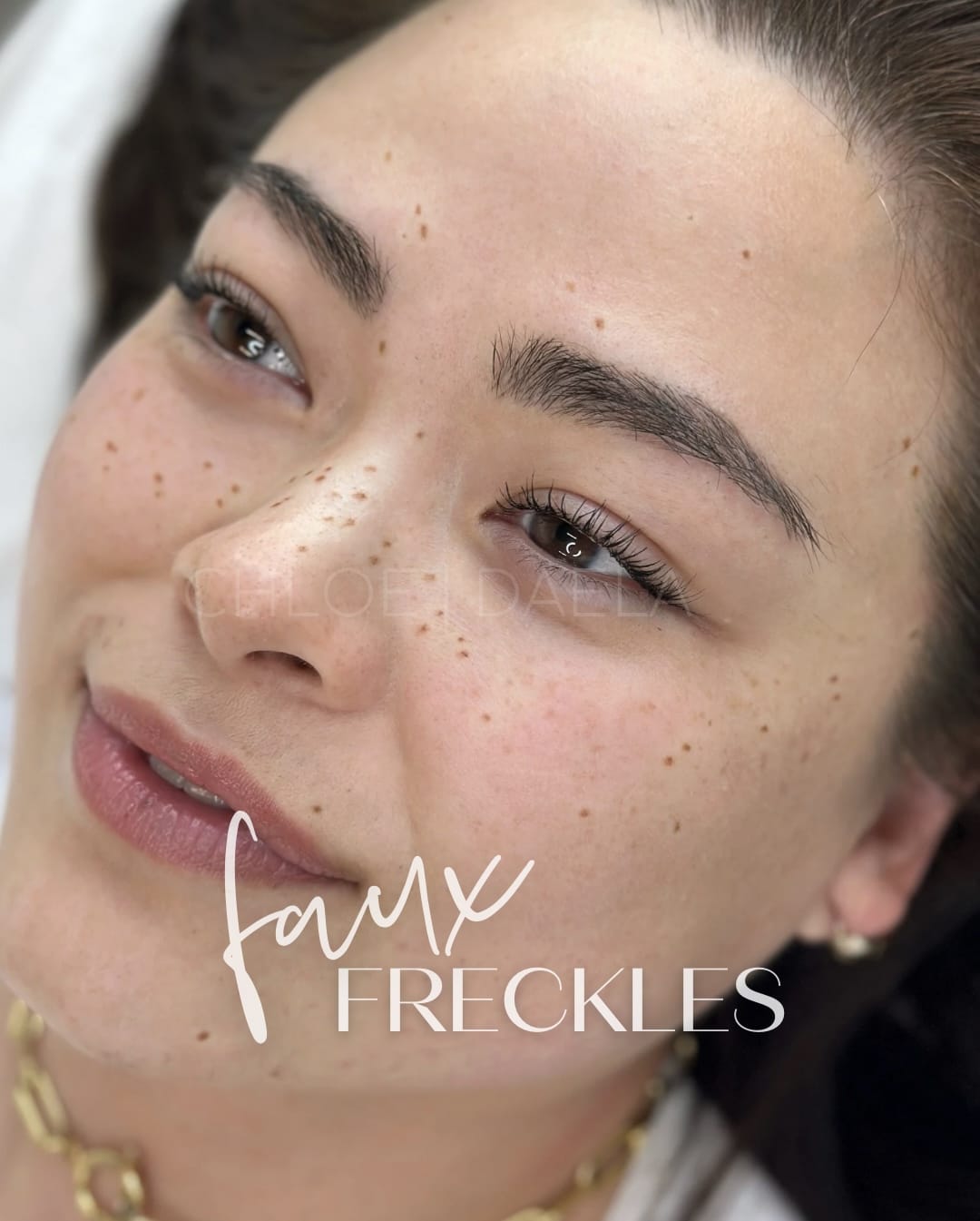 Why Are Faux Freckles So Popular Daela