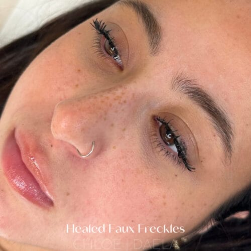 Freckles at DAELA Scottsdale
