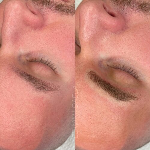 Mens Brows SMP Ink meets DAELA Cosmetic Tattoo