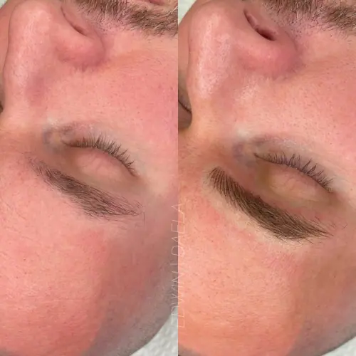 Mens Brows SMP Ink meets DAELA Cosmetic Tattoo