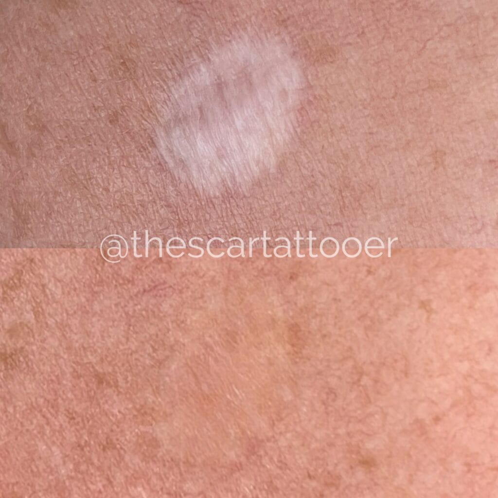 Scar Camouflage in Vancouver Washington at DAELA