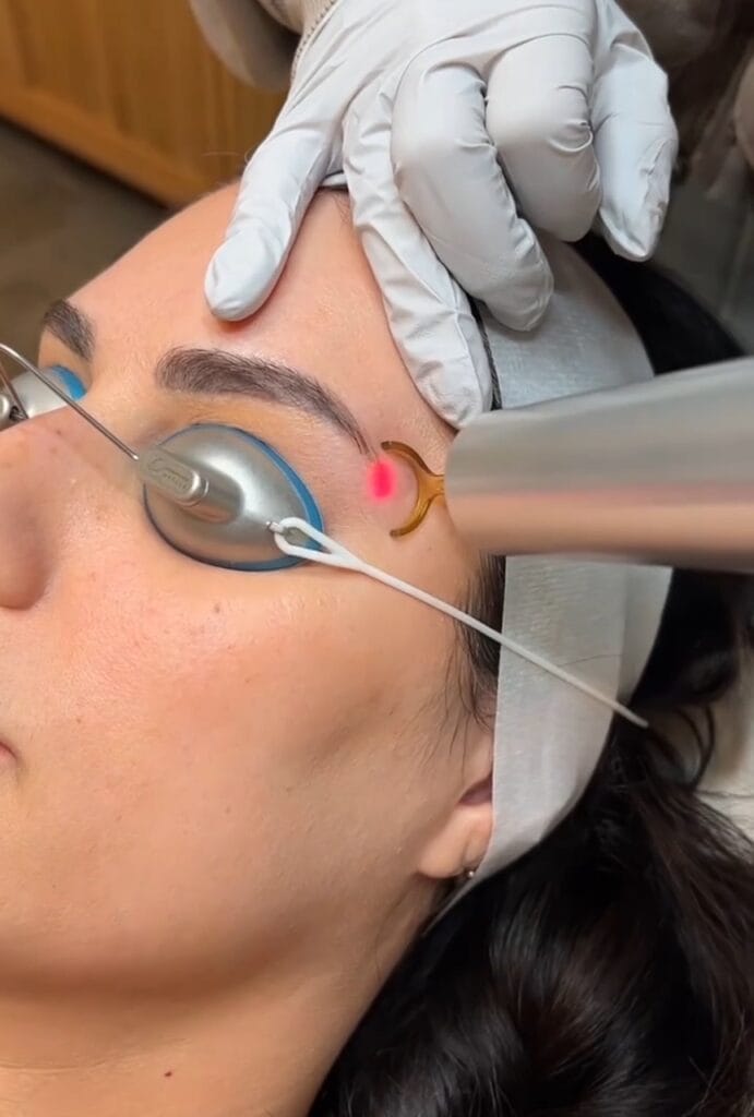 Laser Skin Treatments at DAELA