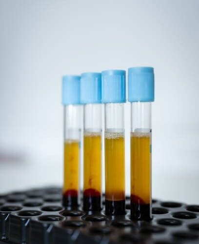 EZ Gel Bio Filler at DAELA Portland