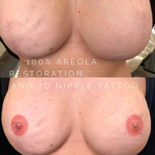 Areola Restoration Tattoo at DAELA Cosmetic Tattoo