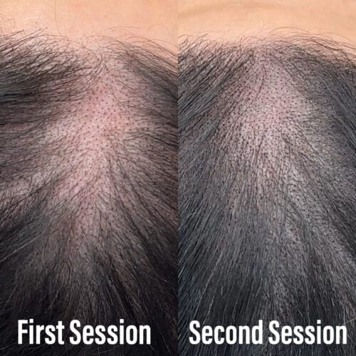 SMP is a multi-session process