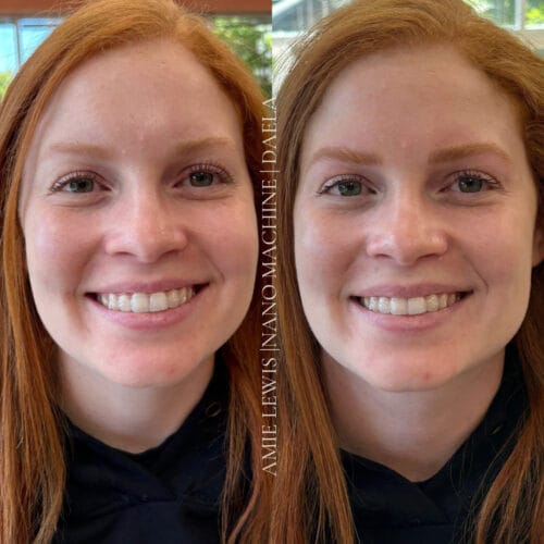 redheads and PMU at DAELA