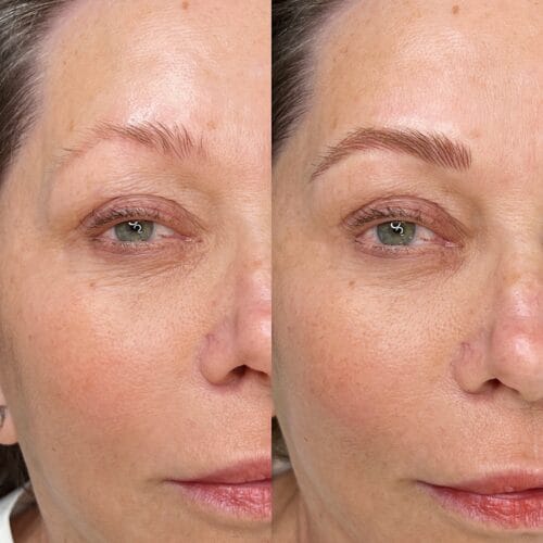 Machine Nano Brows DAELA Cosmetic Tattoo Scottsdale