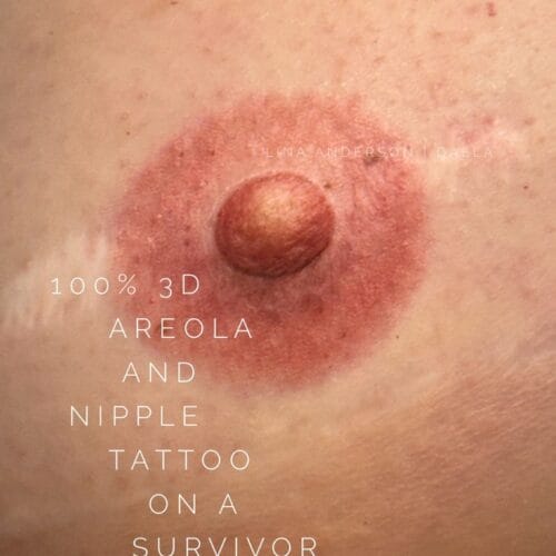 Areola Restoration Tattoo DAELA Cosmetic Tattoo