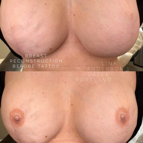 Paramedical Tattooing DAELA Cosmetic Tattoo