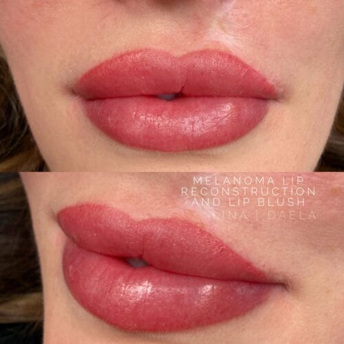 lip blush for scarring