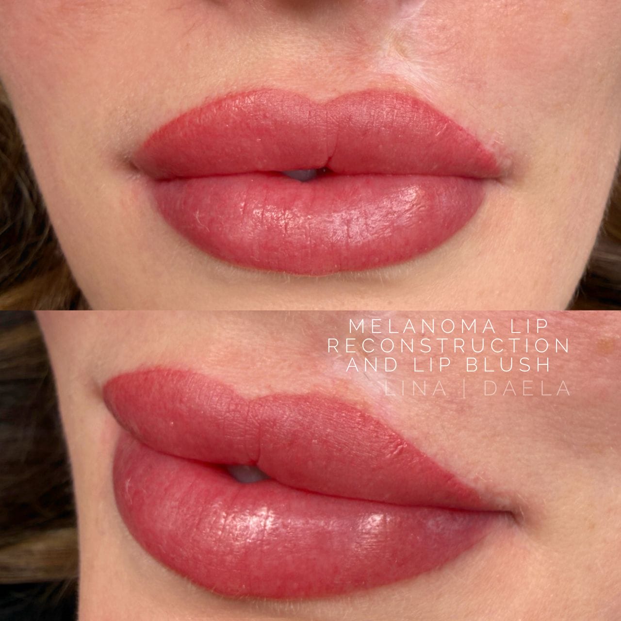 lip blush for scarring