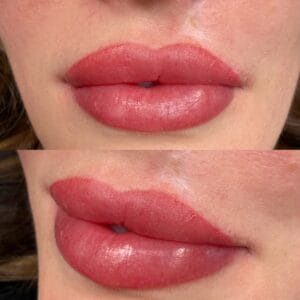 lip blush after melanoma surgery 4