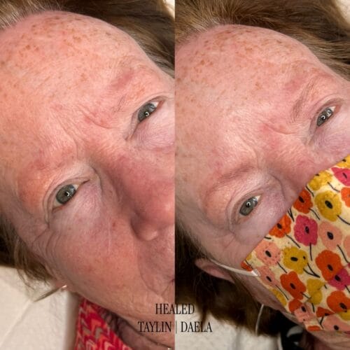 Nano machine Hairstroke Brows at DAELA
